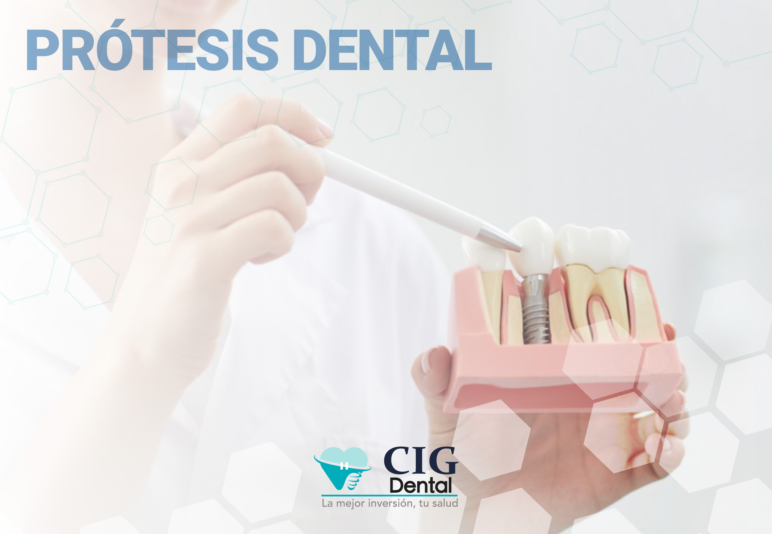 Protesis Dental